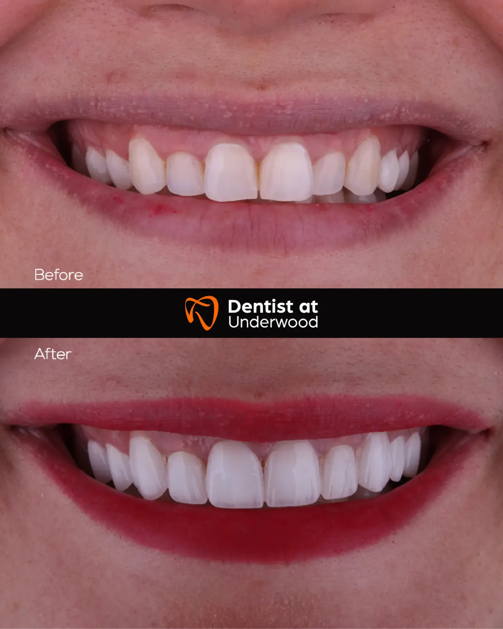Dental treatment case 5