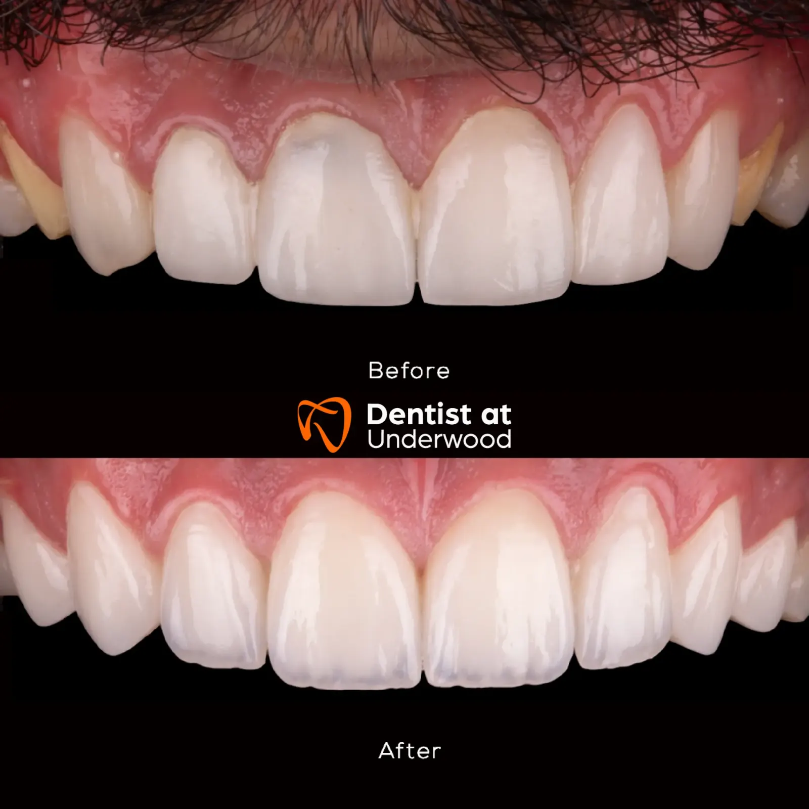 Dental treatment case 13