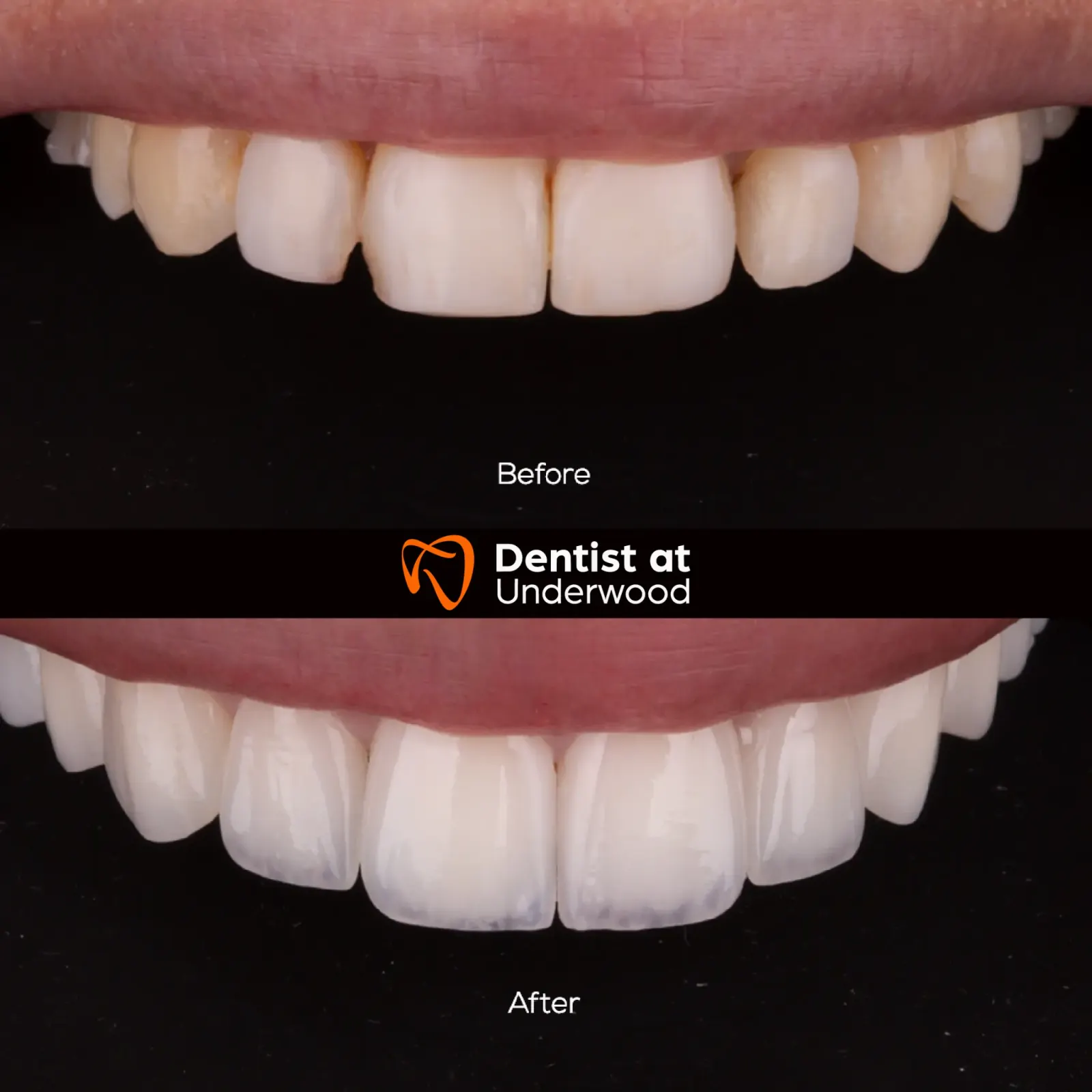 Dental treatment case 14