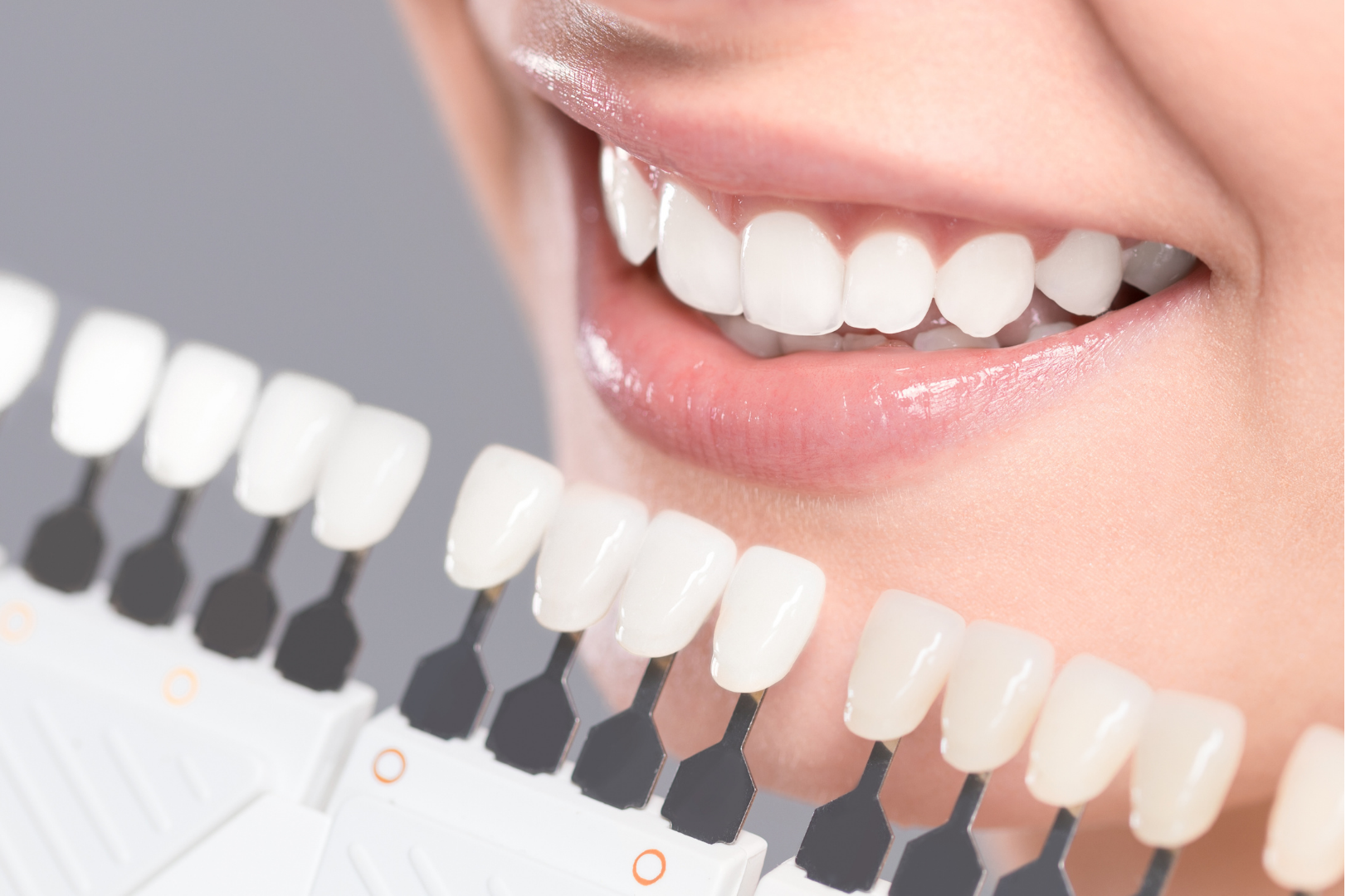 Teeth-Whitening-e1633563054902.png