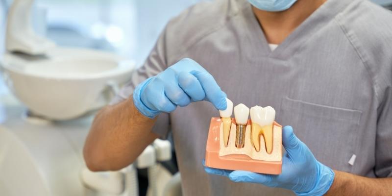 dental implants example