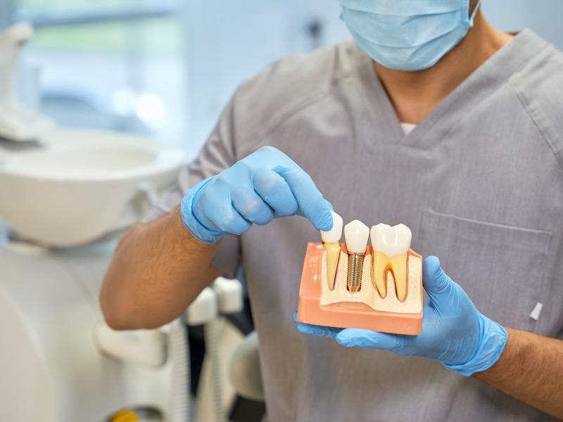 dental implants blog image